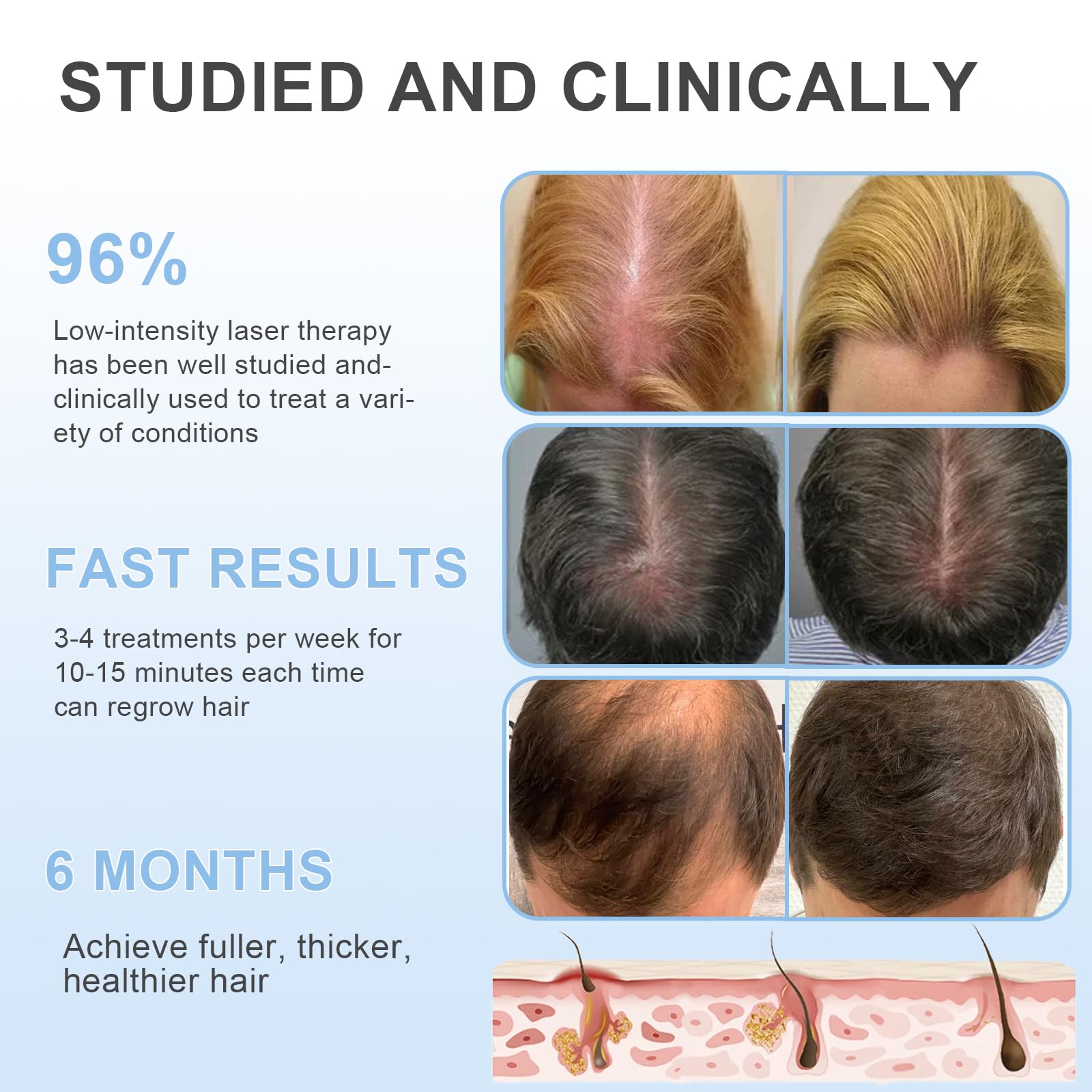 Obiredk Laser Hair Growth Comb packaging kit shows compact home-use setup.