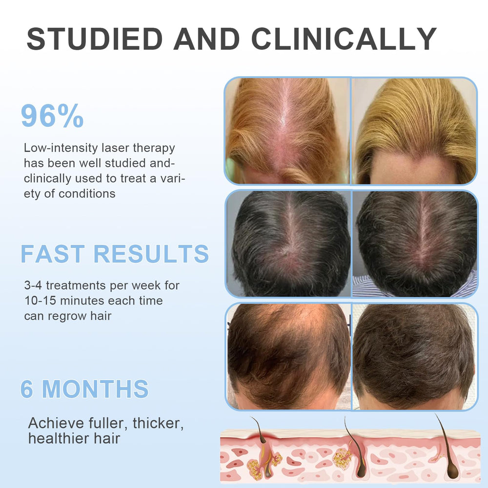 Obiredk Laser Hair Growth Comb packaging kit shows compact home-use setup.