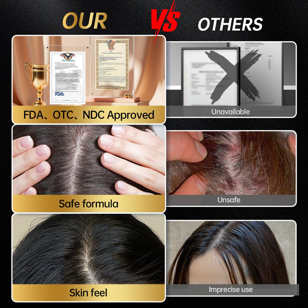 OCSINL Minoxidil application scene shows simple daily care ritual.