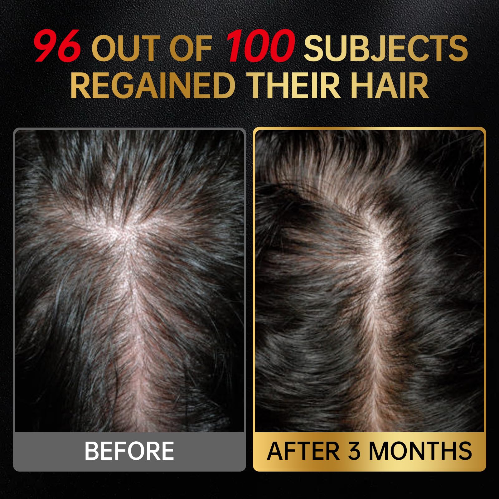 OCSINL Minoxidil featuring batana oil signals nourishing scalp care.