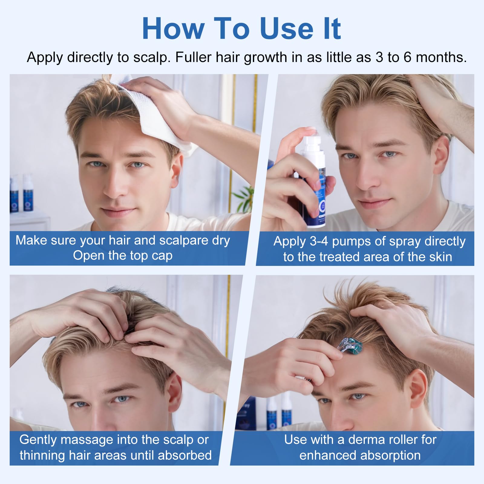 OCVWJKD 5% minoxidil bottle—precise scalp targeting wherever thinning appears