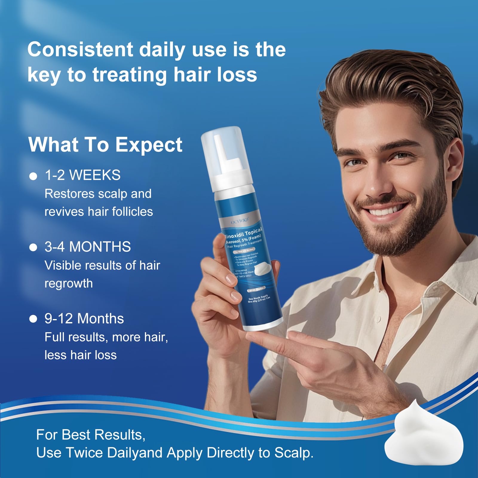 OCVWJKD minoxidil foam applied to beard area for possible beard growth