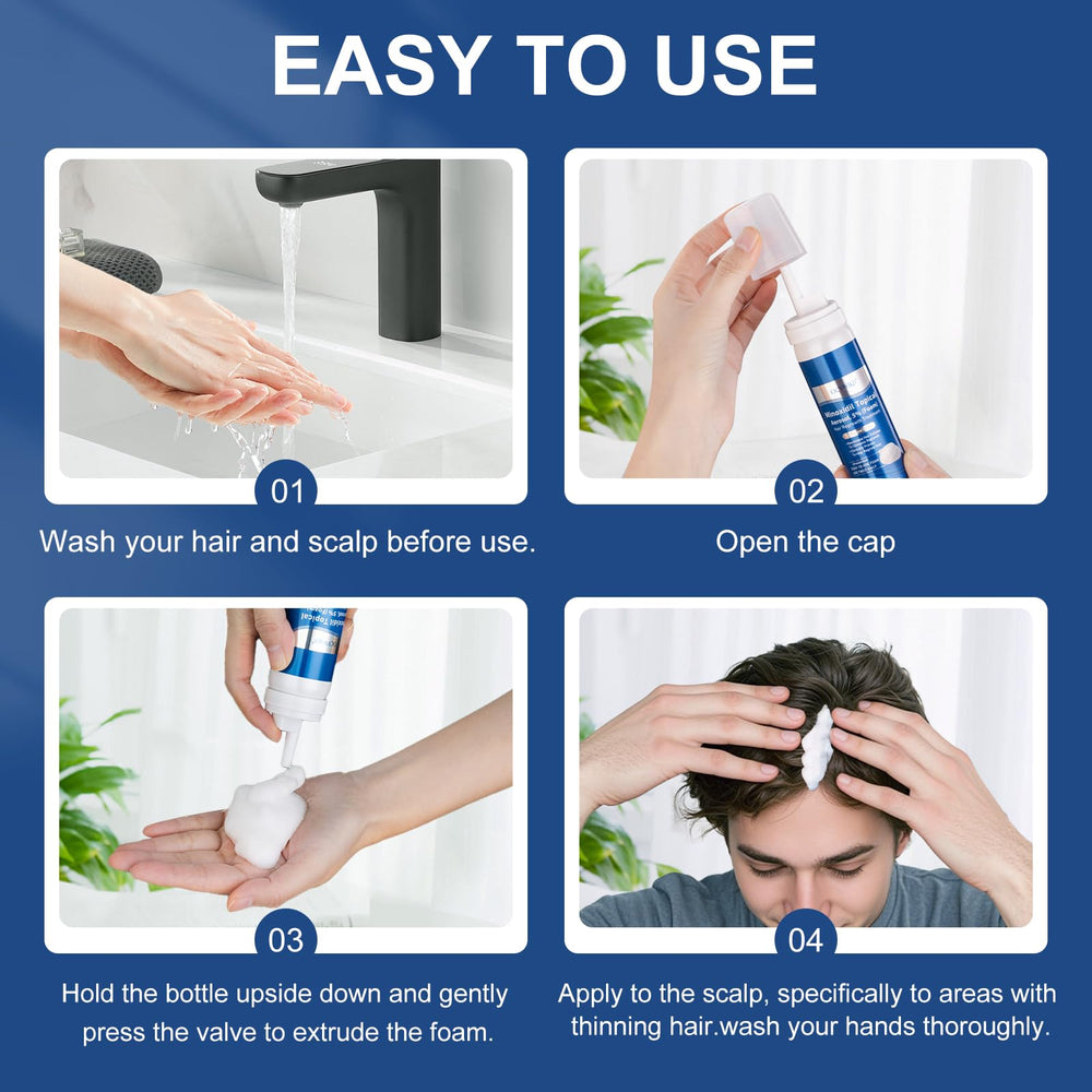 OCVWJKD unisex minoxidil foam application on hands for scalp care