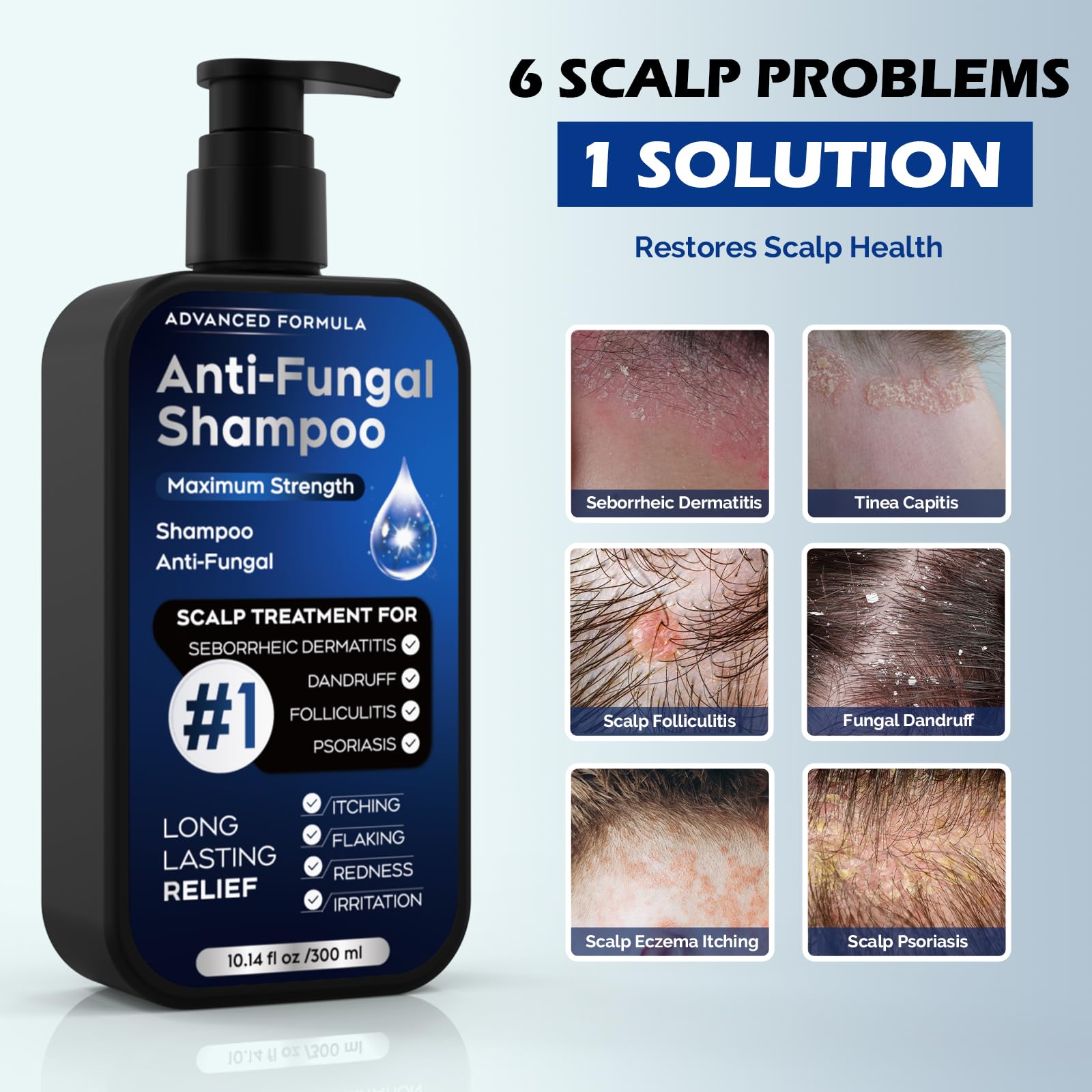 Oely antifungal shampoo lather shows gentle cleansing with natural extracts.