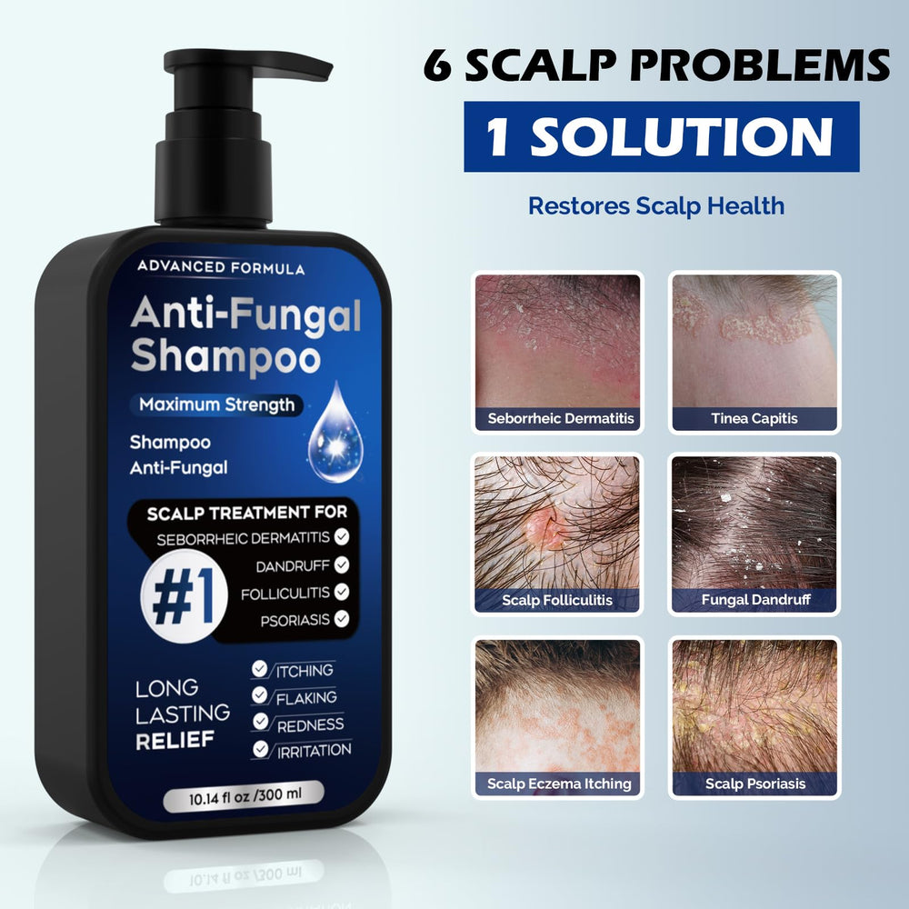 Oely antifungal shampoo lather shows gentle cleansing with natural extracts.