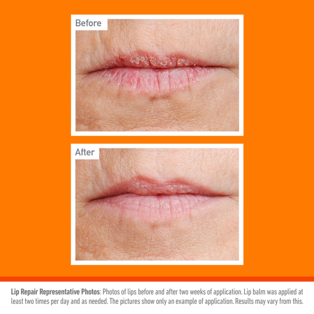 O'Keeffe's Lip Repair application-closeup shows quick absorption into lips
