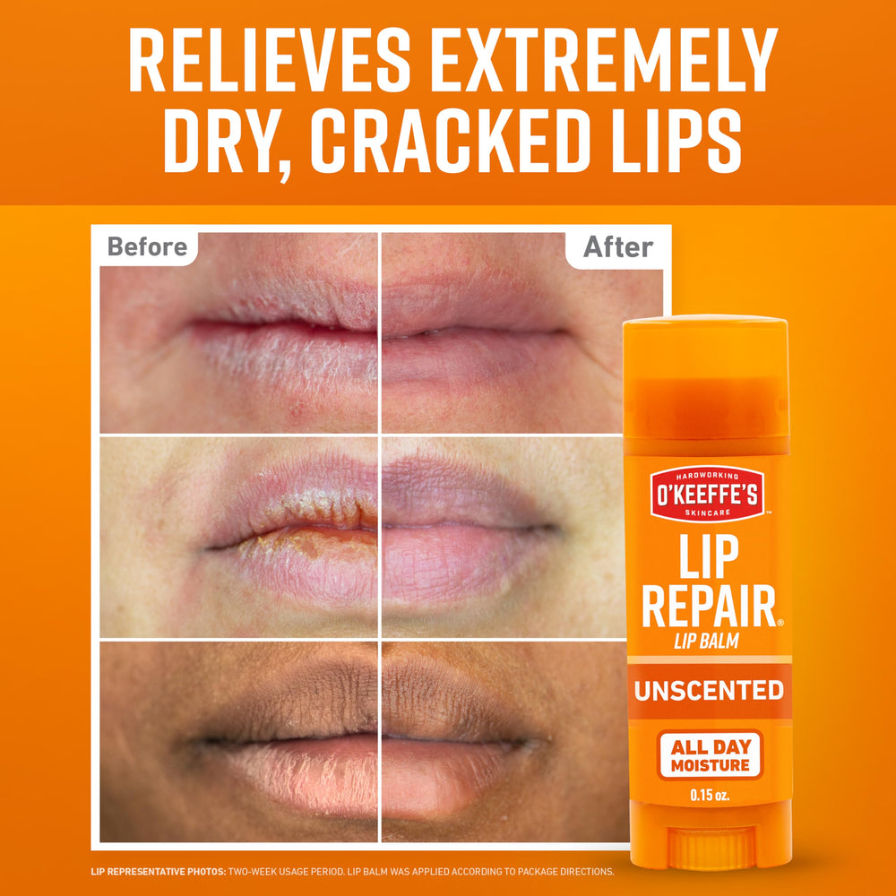 O'Keeffe's Lip Repair application close-up for quick relief of cracked lips.