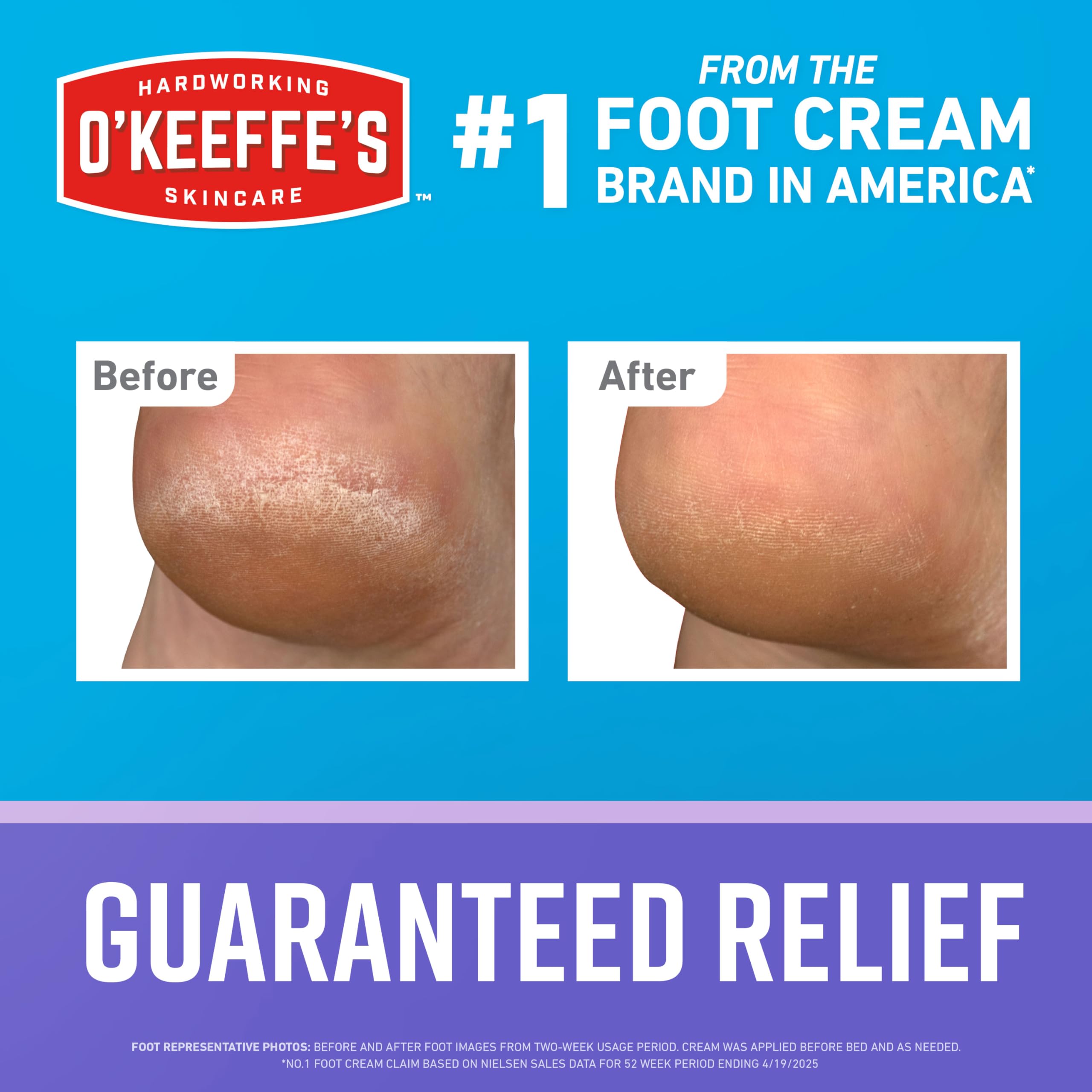 O'Keeffe's Night Treatment being applied to dry feet for overnight hydration.