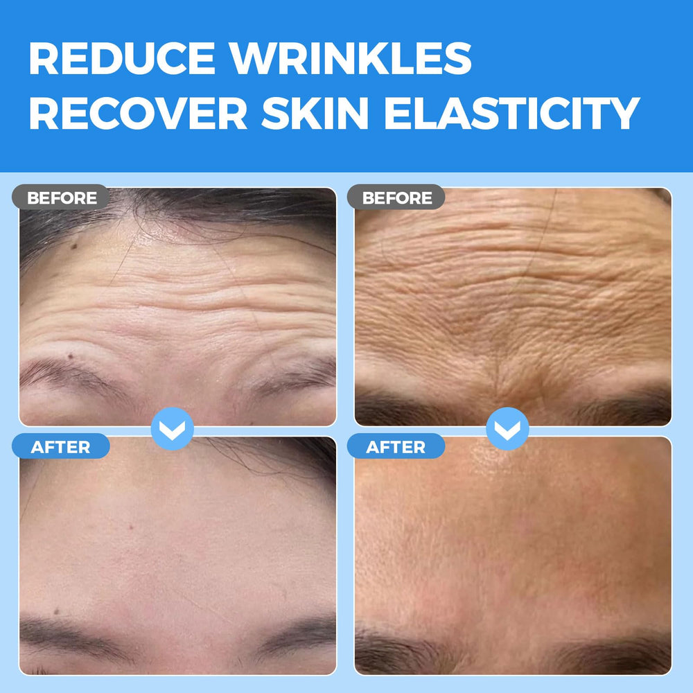 Okela forehead patches application on skin boosts elasticity with collagen for a firmer look