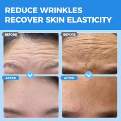 Okela forehead patches application on skin boosts elasticity with collagen for a firmer look
