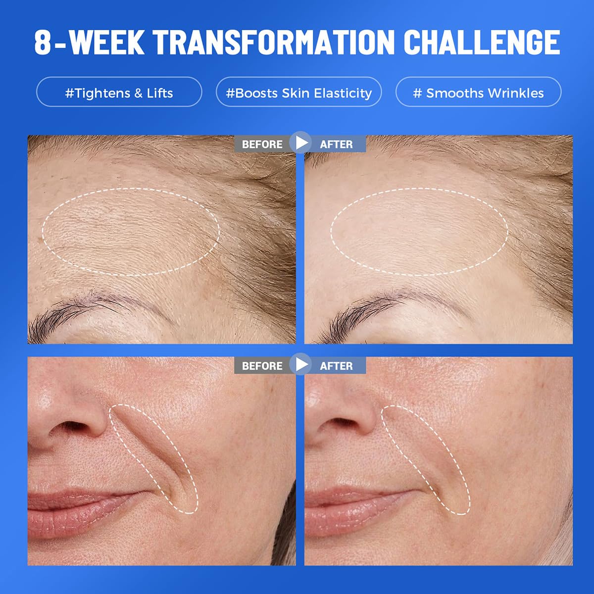 Okela hydrogel mask application demonstrates cooling hydration overnight.