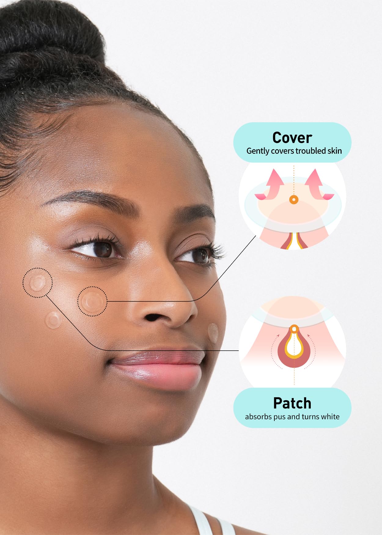 OLIVE YOUNG Care Plus Spot Patch Big on skin offering invisible coverage
