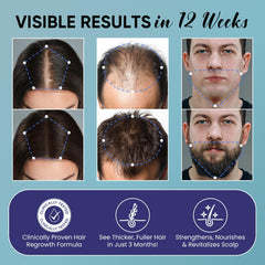 OLIVITA Biotin Rosemary scalp nourishment illustration