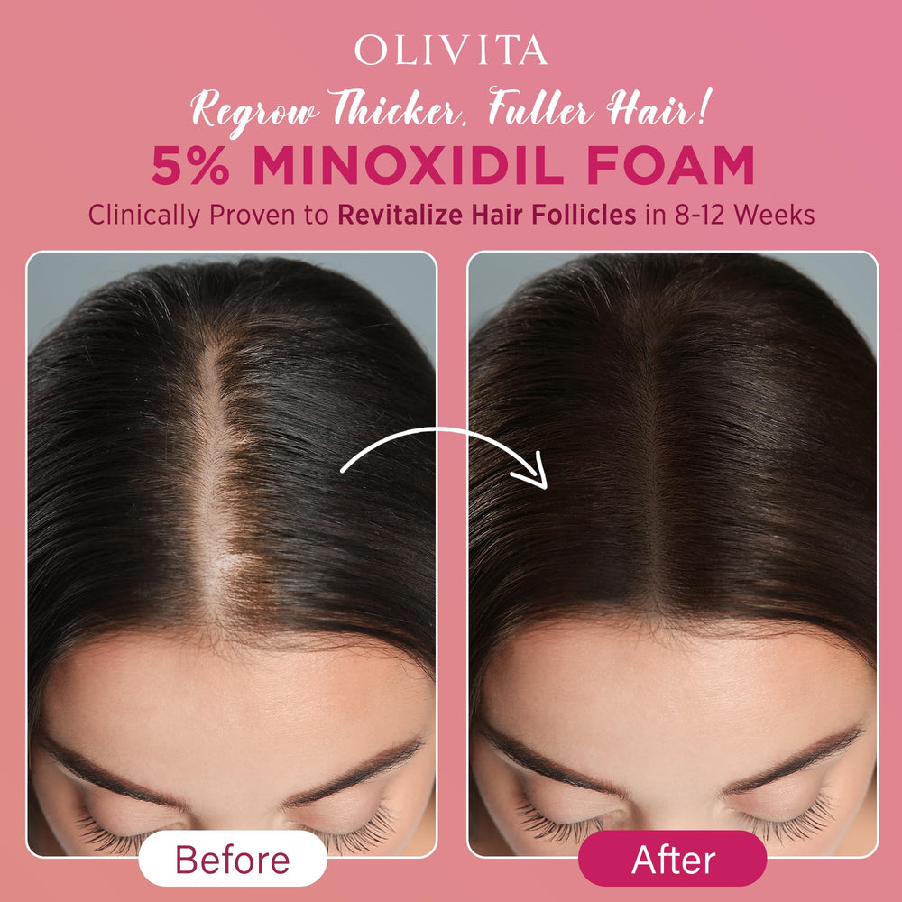 OLIVITA minoxidil foam applied to scalp for nourishment