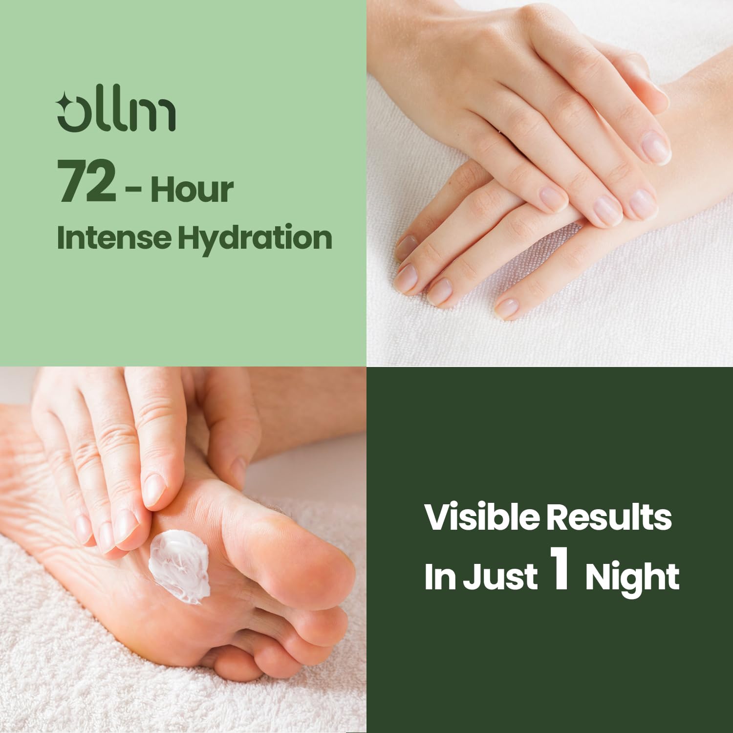 OLL M Urea Cream 40% cracked heels close-up shows healing potential.