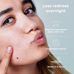 OMMA acne patch applied on a pimple showing targeted spot treatment overnight.