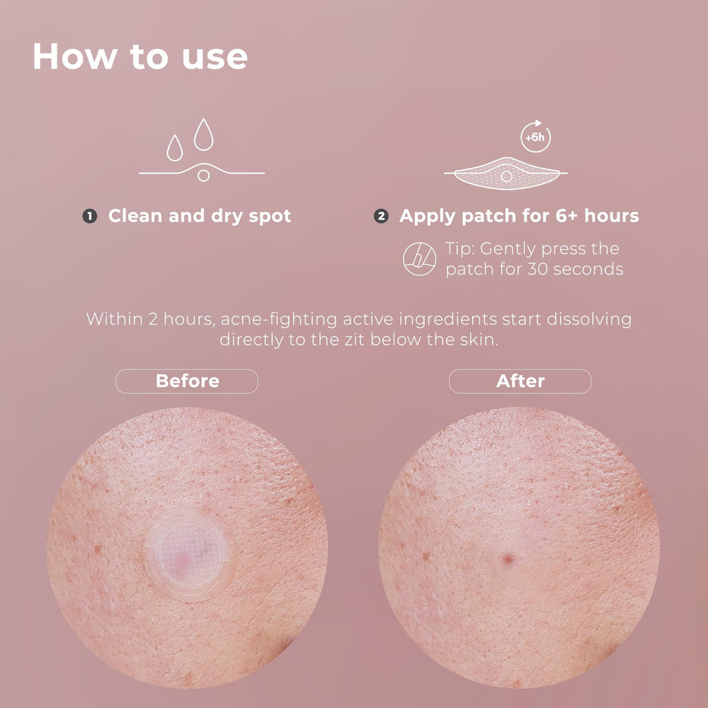 OMMA vegan cruelty-free patch made in South Korea for gentle skincare routines.
