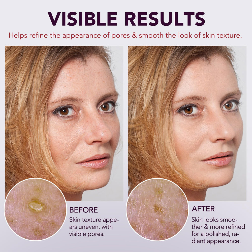 OMZOK Sensitive-Skin Rice Peel packaging illustrates gentle exfoliation.