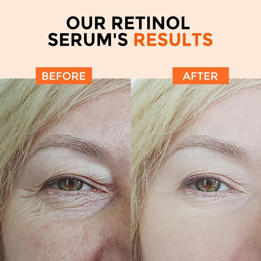 +1HEROLABS night serum texture reveals lightweight, radiant finish for all skin types.