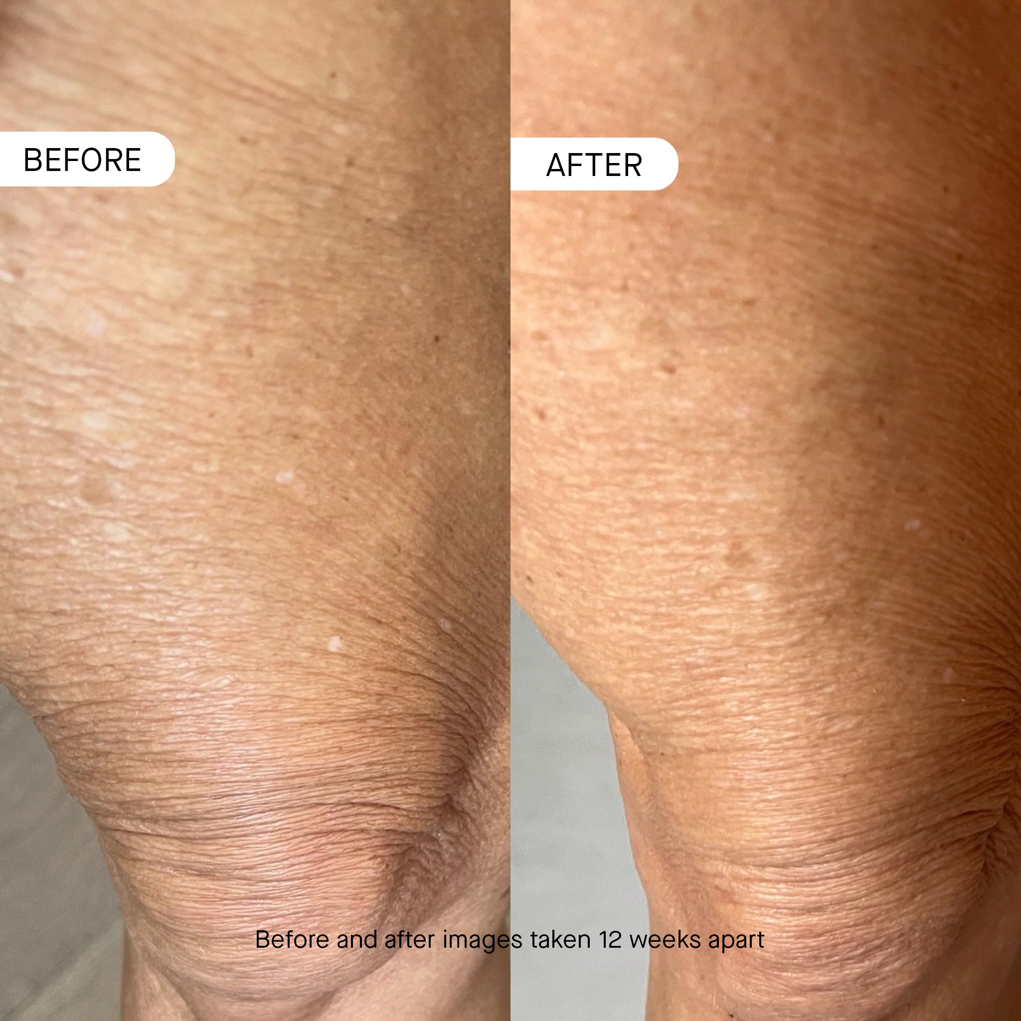 OneSkin BODY OS-01 hydration effect on damp skin promotes lasting moisturization.