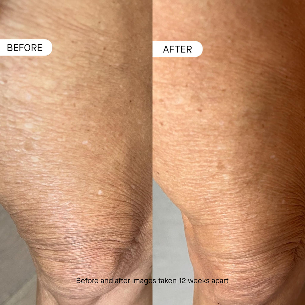 OneSkin BODY OS-01 hydration effect on damp skin promotes lasting moisturization.