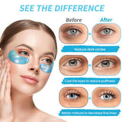Onespring eye patches closeup shows hydrating gel formulas that soothe tired-looking under-eye skin.