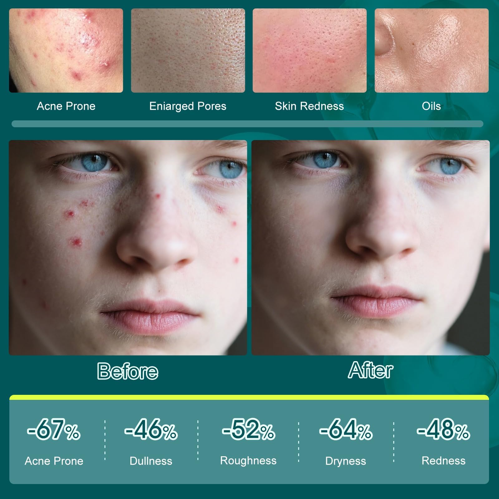 Onkessy facial cream providing moisture and oil balance