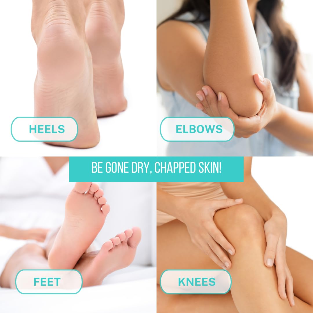 Onyx Professional dry-cracked-feet-treatment balm applied on heel area for smoothing