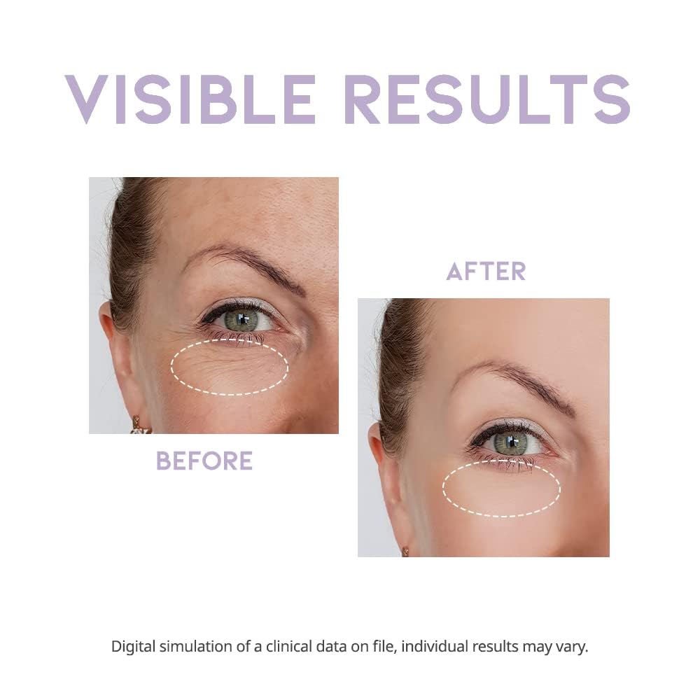 #OOTD eye cream wrinkles - supports elasticity for a smoother contour.
