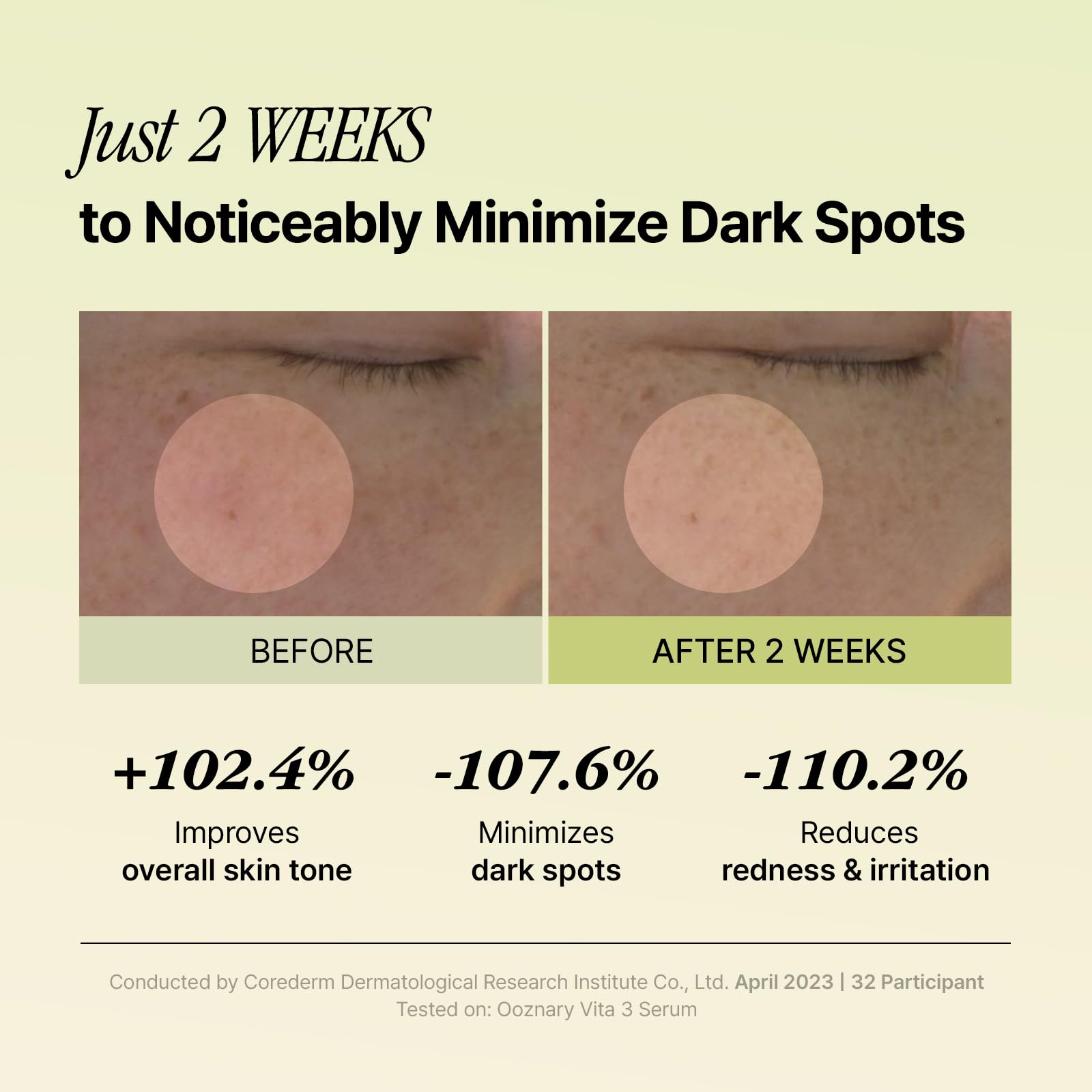 OOZNARY Vita 3 Serum Madecassoside close-up emphasizing soothing effect on irritated skin.
