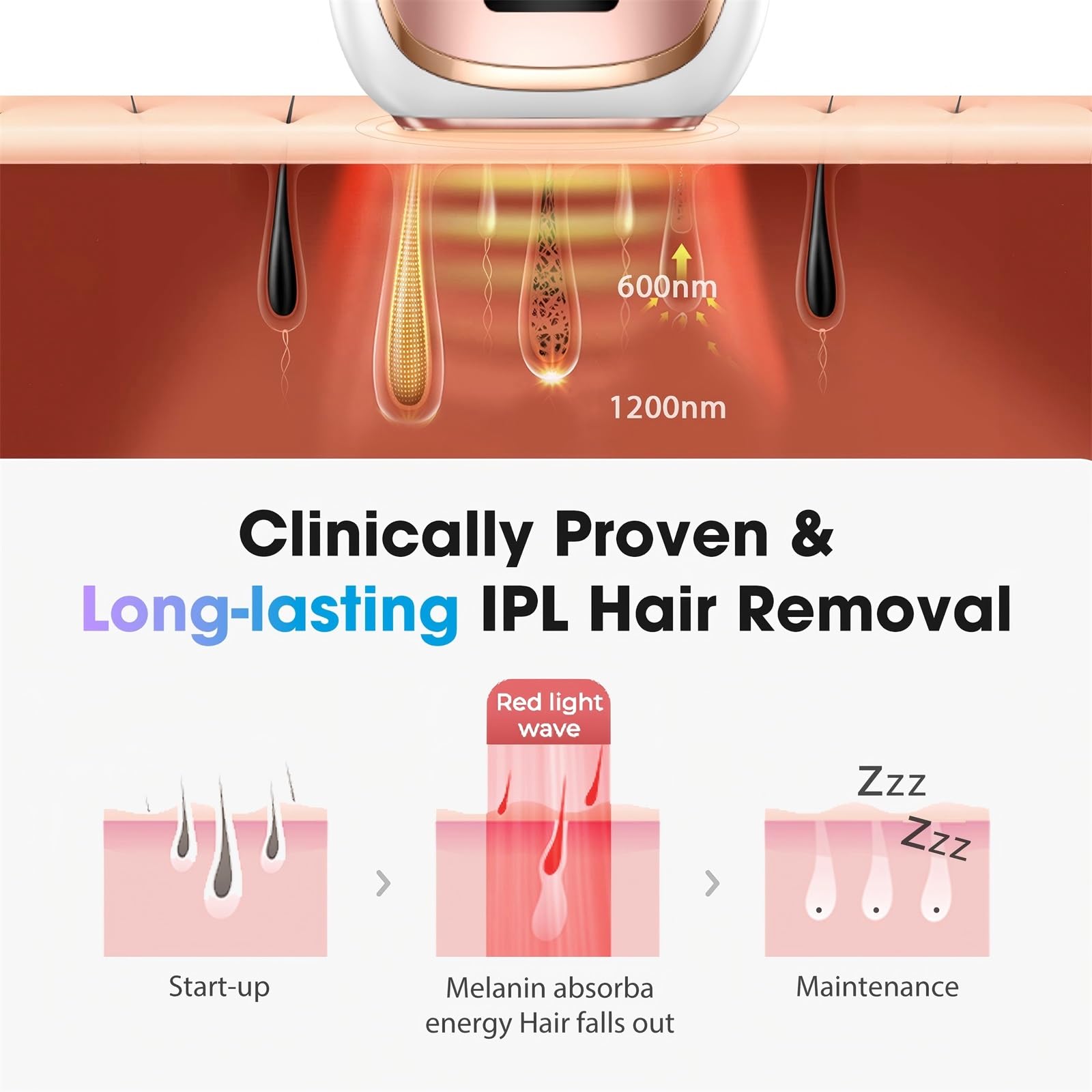 Oreeth IPL bikini-area treatment shot showing targeted precision.