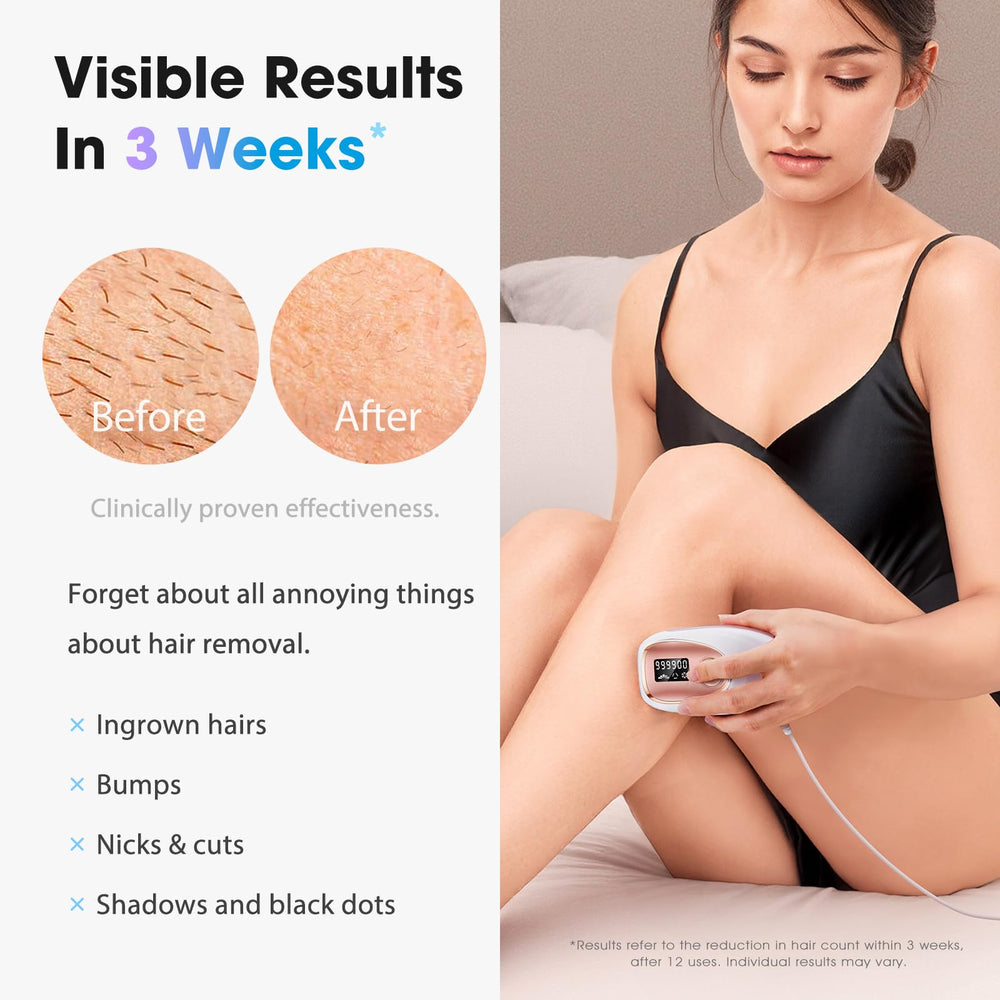 Oreeth IPL device side view highlighting portable design for quick full-body sessions.