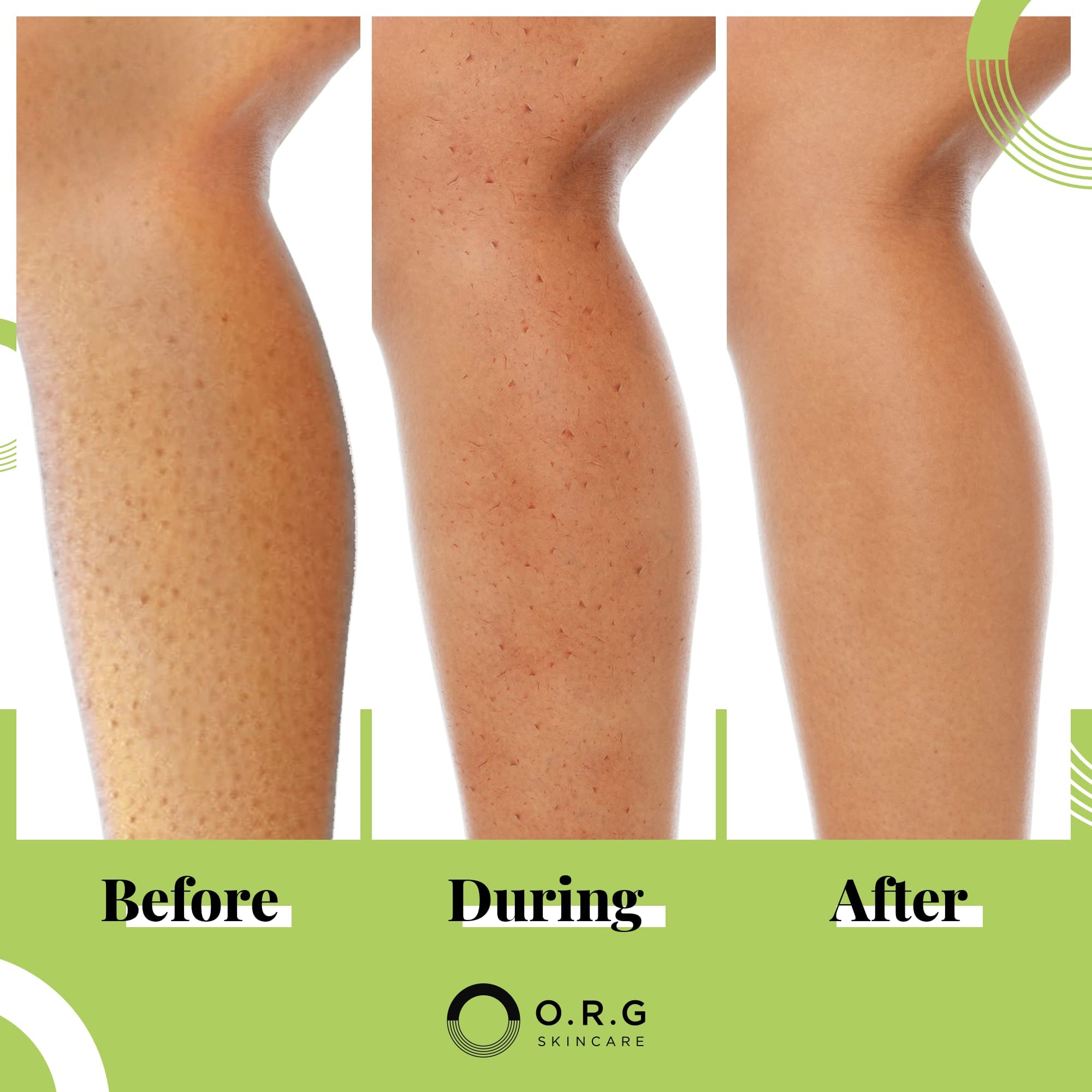 O.R.G. Skincare aloe leaf extract close-up emphasizing soothing hydration during exfoliation.