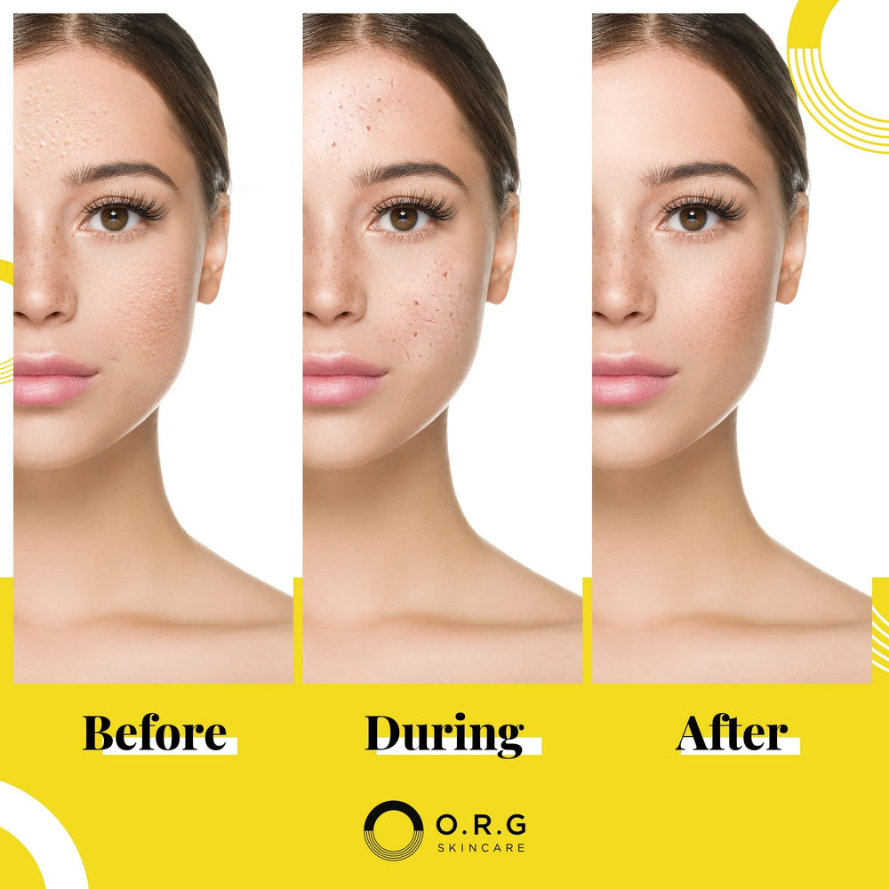 O.R.G. Skincare USA-made natural formula bottle highlights clean ingredients.
