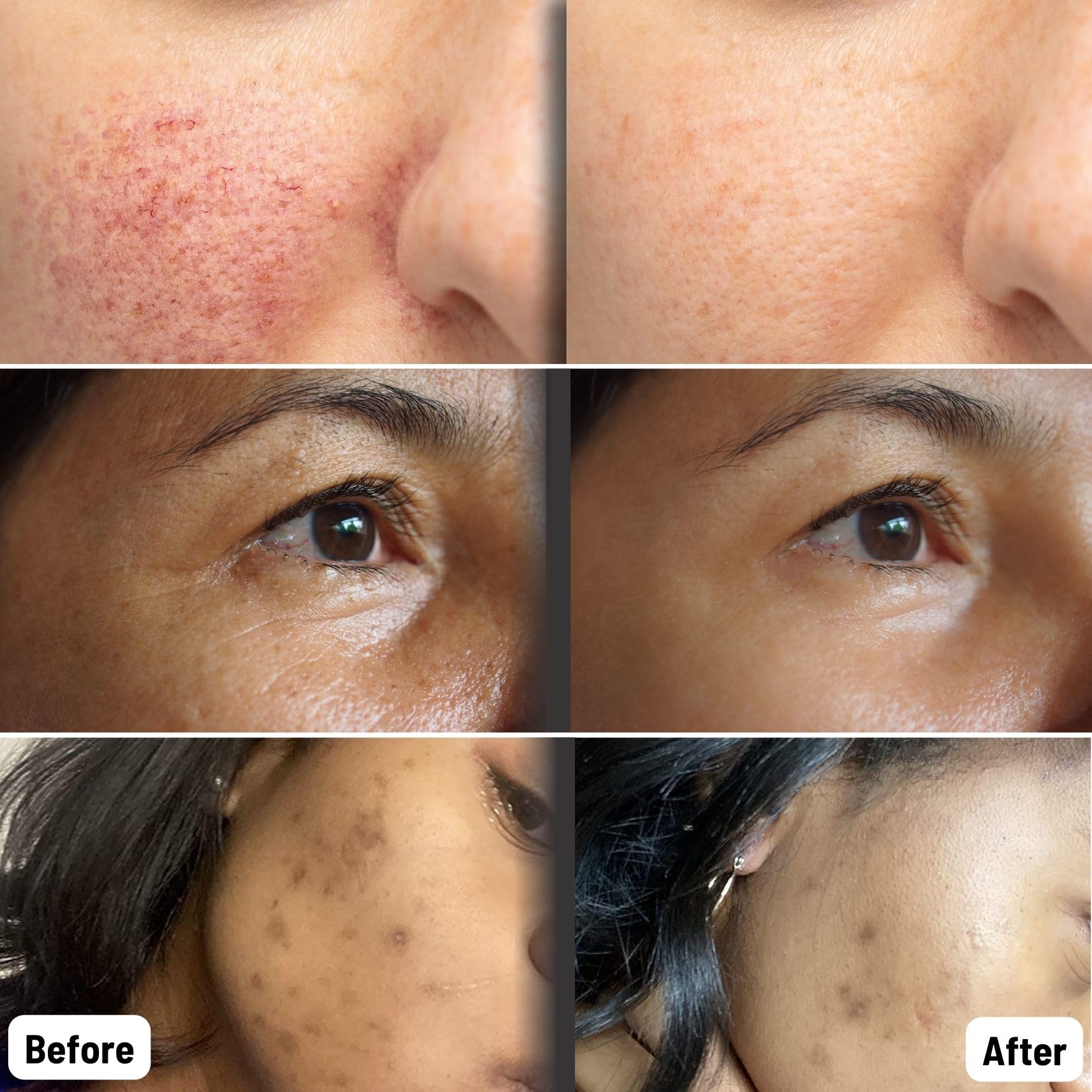 ORGAID mask being applied to the face for refreshing care.