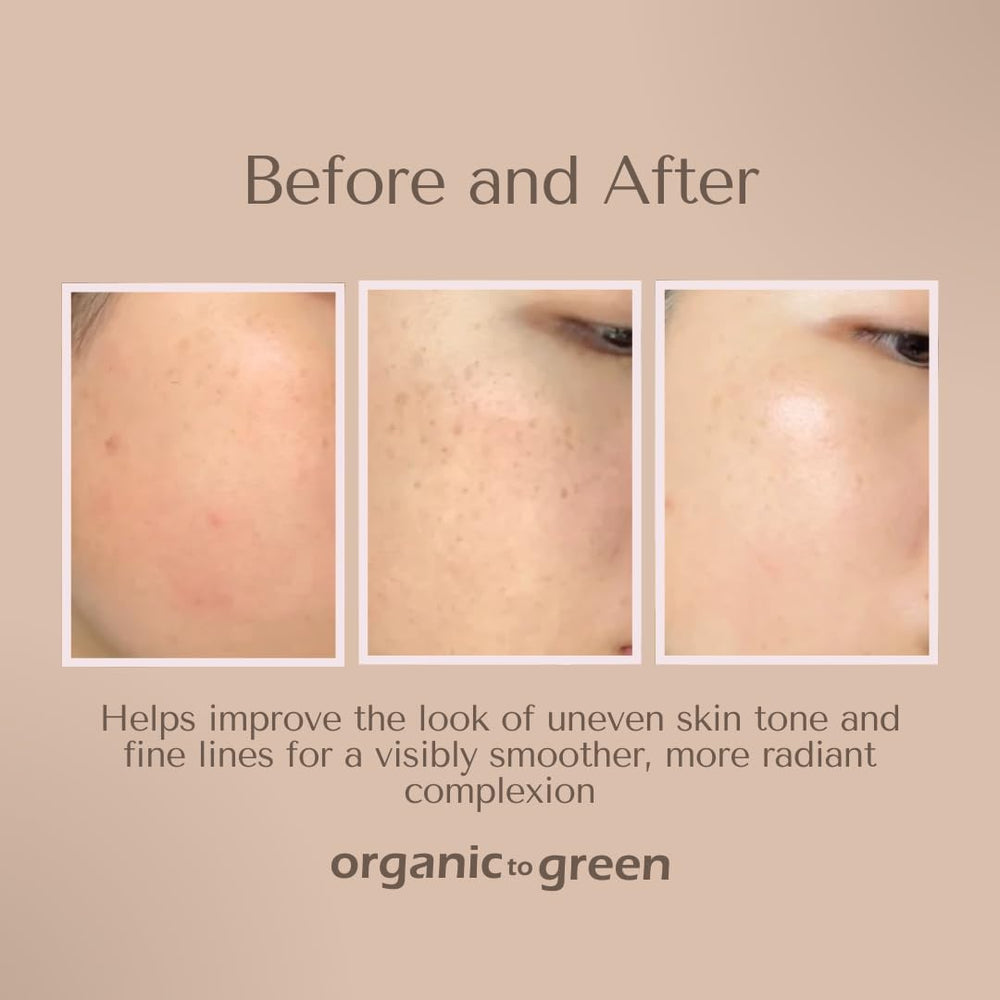 Organic To Green Kojic Turmeric Soap lavender scent bar for calming nighttime routine.
