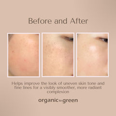 Organic To Green Kojic Turmeric Soap lavender scent bar for calming nighttime routine.