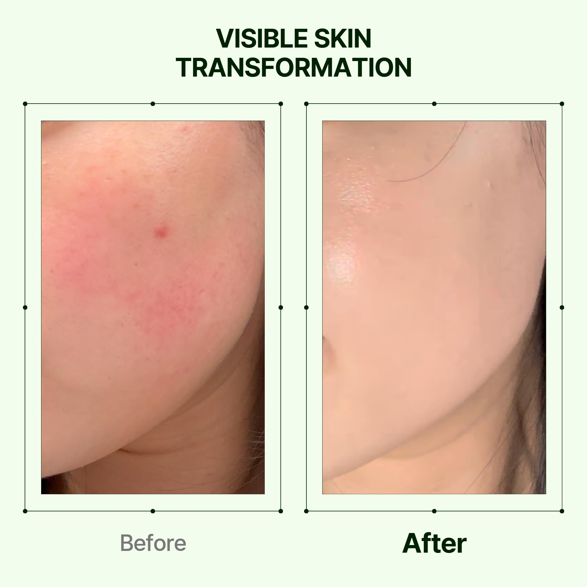 Centella Asiatic and Mugwort extracts in Orien Mugwort Zero Film Moisturizer calm irritation
