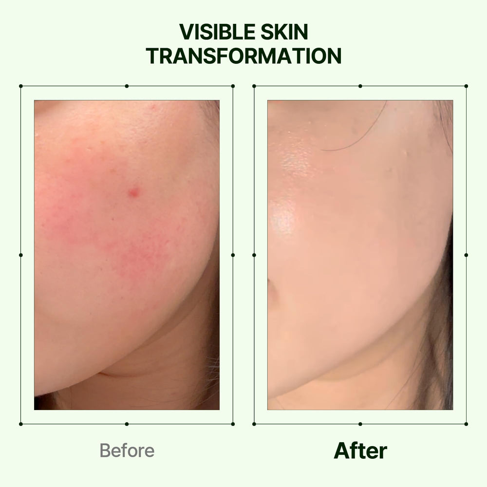 Centella Asiatic and Mugwort extracts in Orien Mugwort Zero Film Moisturizer calm irritation