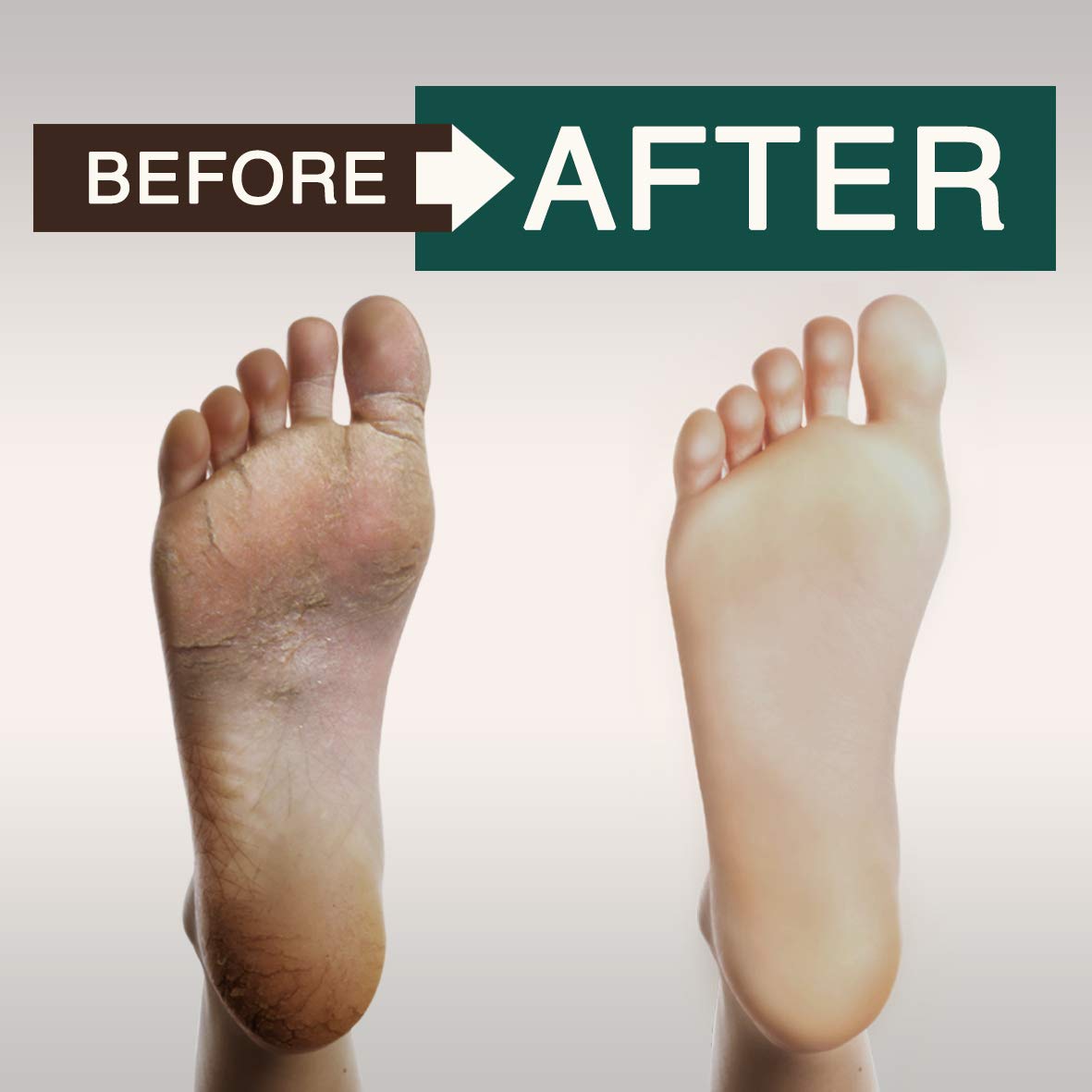 ORISO Tea Tree Oil Body Wash sulfate-free packaging communicates clean formulation.