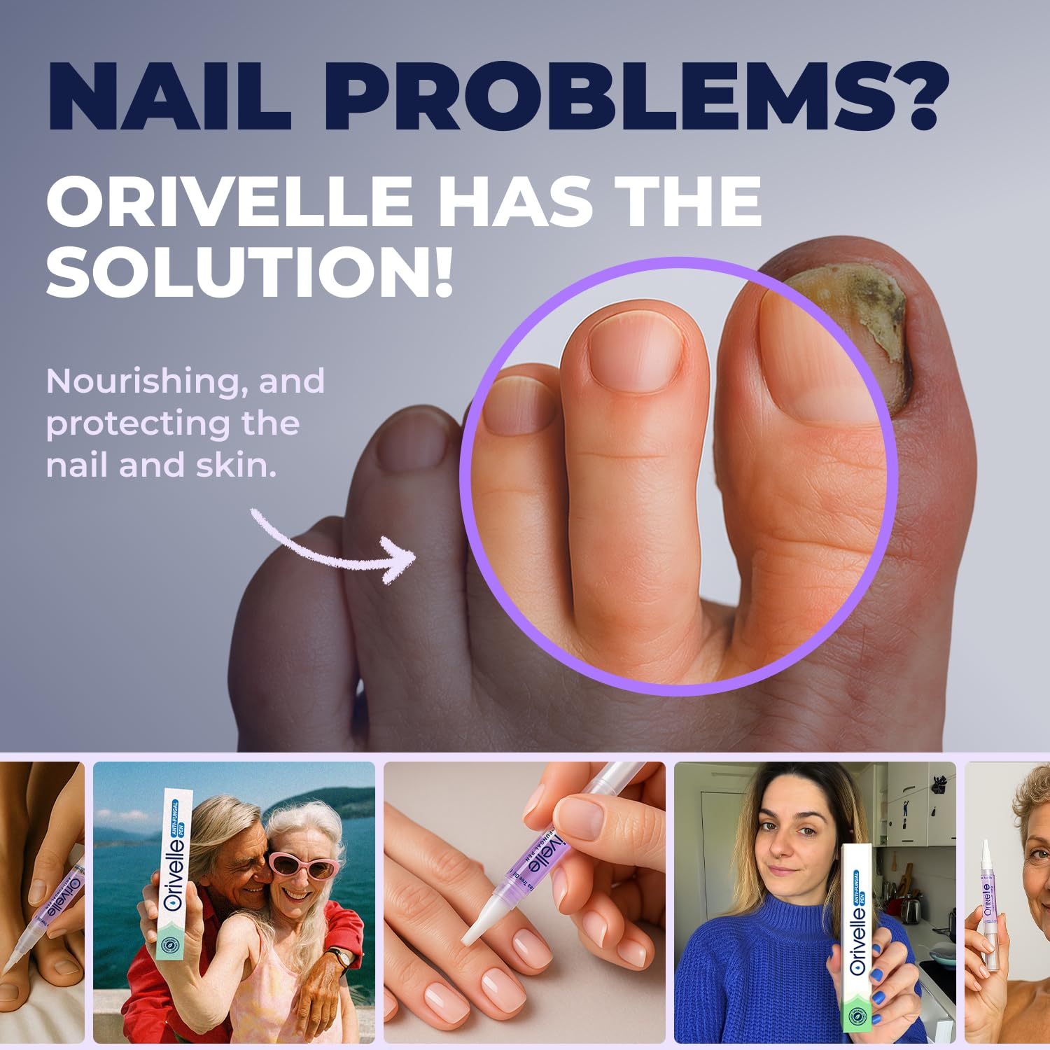 Orivelle Nail Fungus Pen pack-of-2 packaging emphasizes value and convenience.