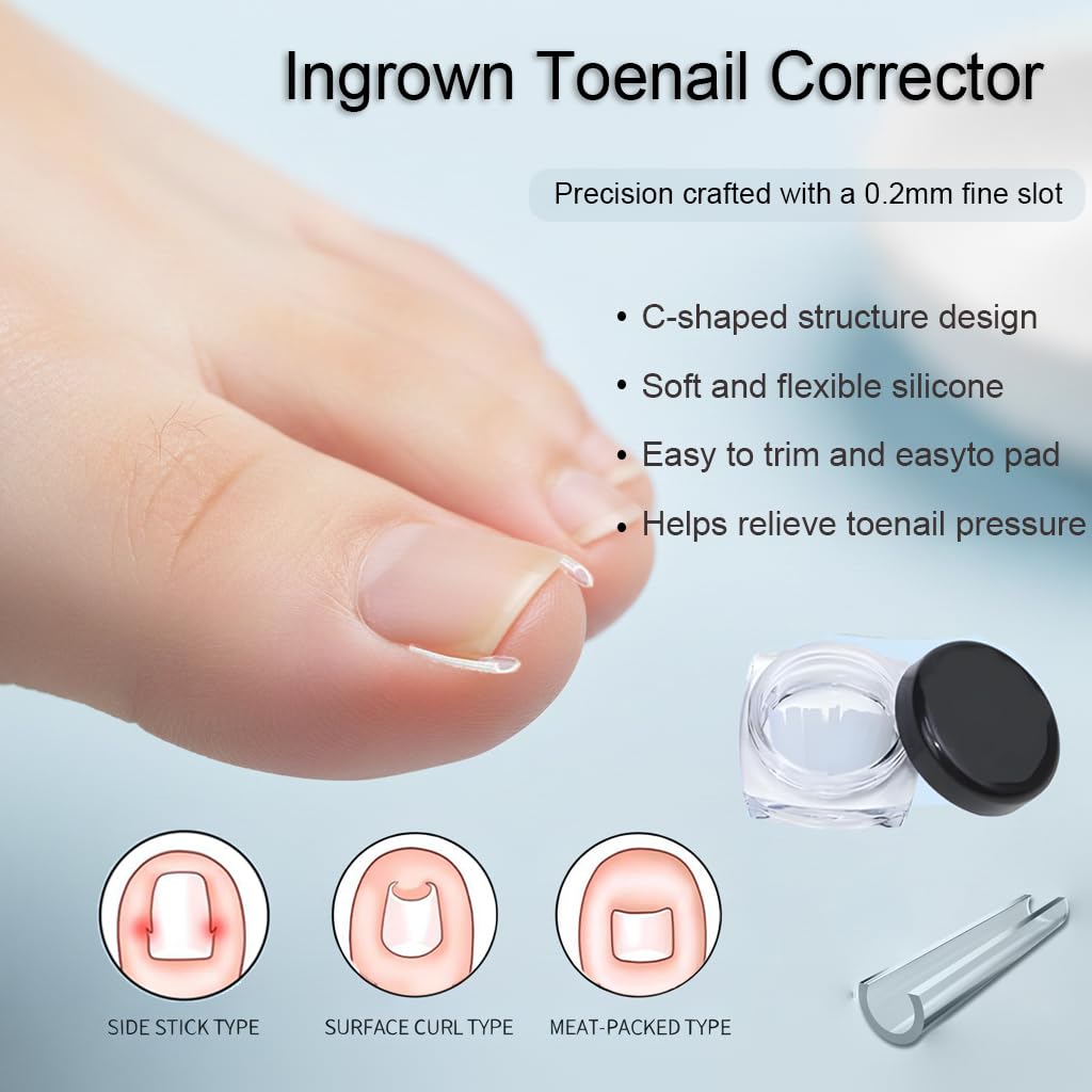 Orparst curved nail correction patch flexible design fits curved or thick nails.