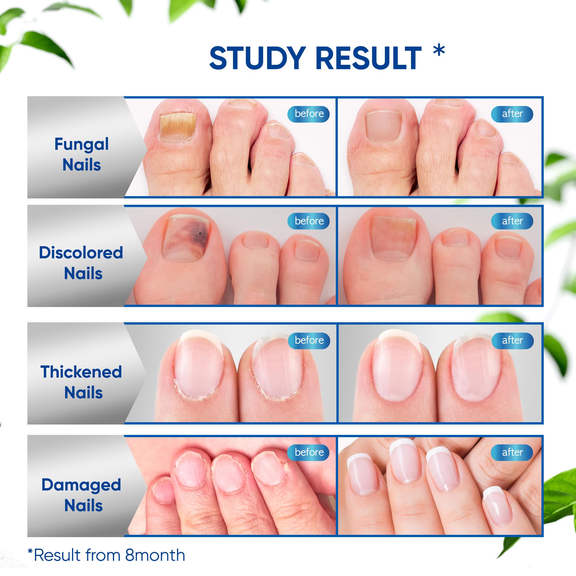 OSIMOON liquid absorption close-up highlighting rapid penetration into the nail bed.