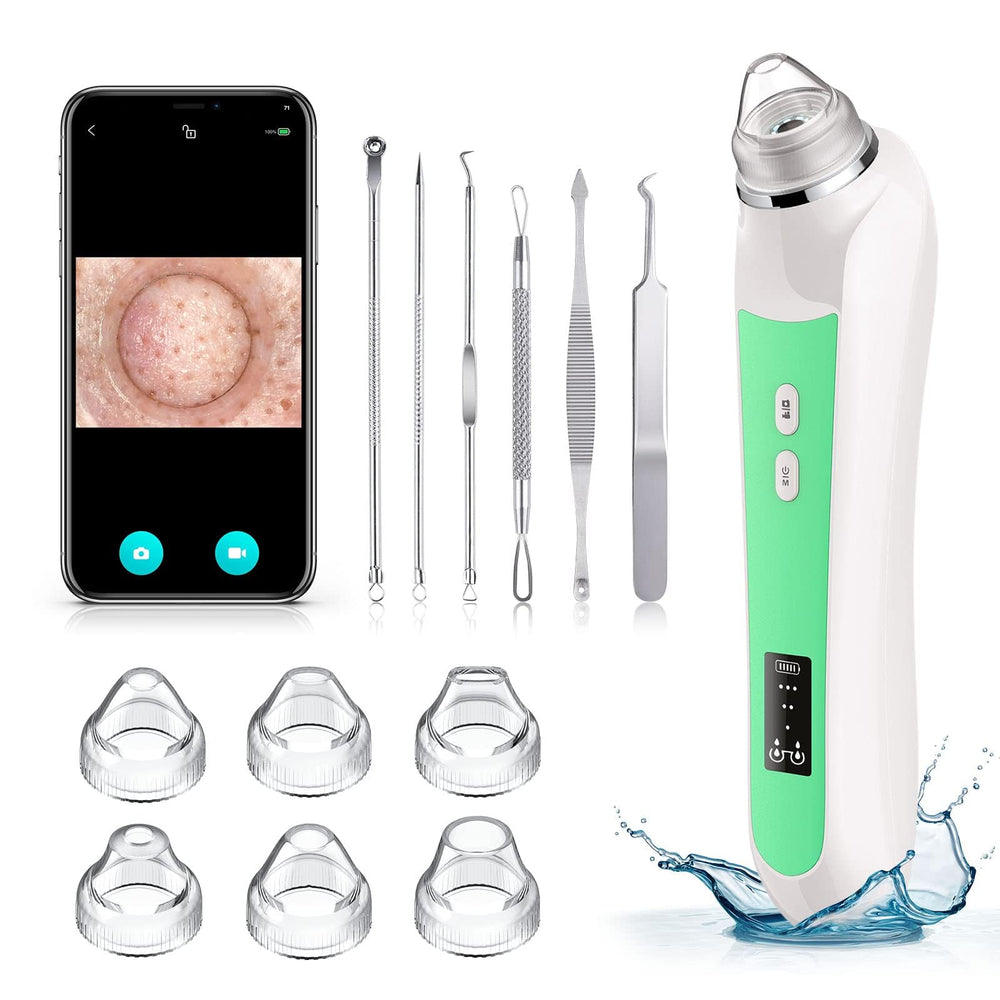 Ottleba pore remover camera view with 1080p live feed and lights for precise observation