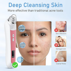 Ottleba six replaceable suction heads arranged for various pore types