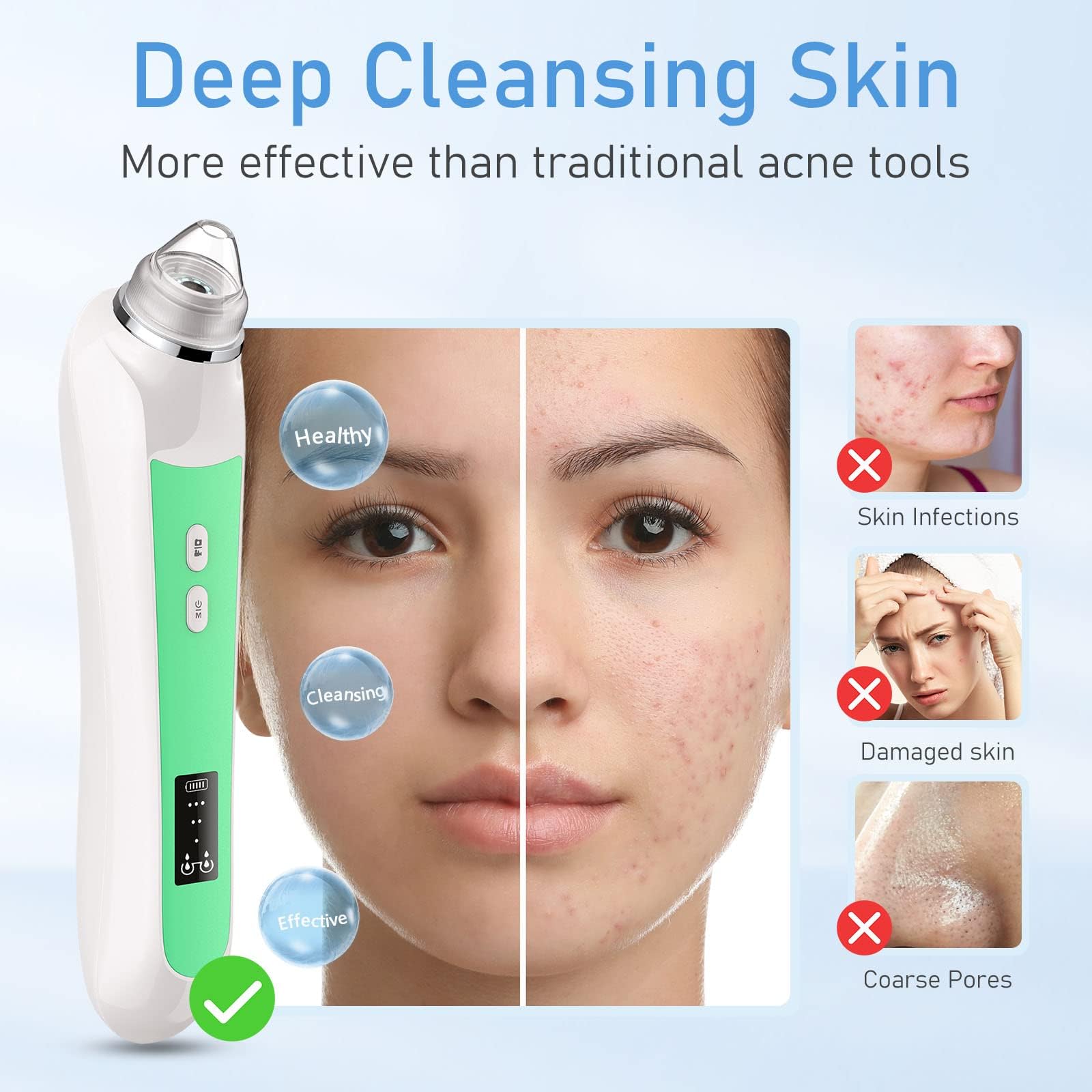 Ottleba device showing three suction levels for customizable skincare on sensitive areas