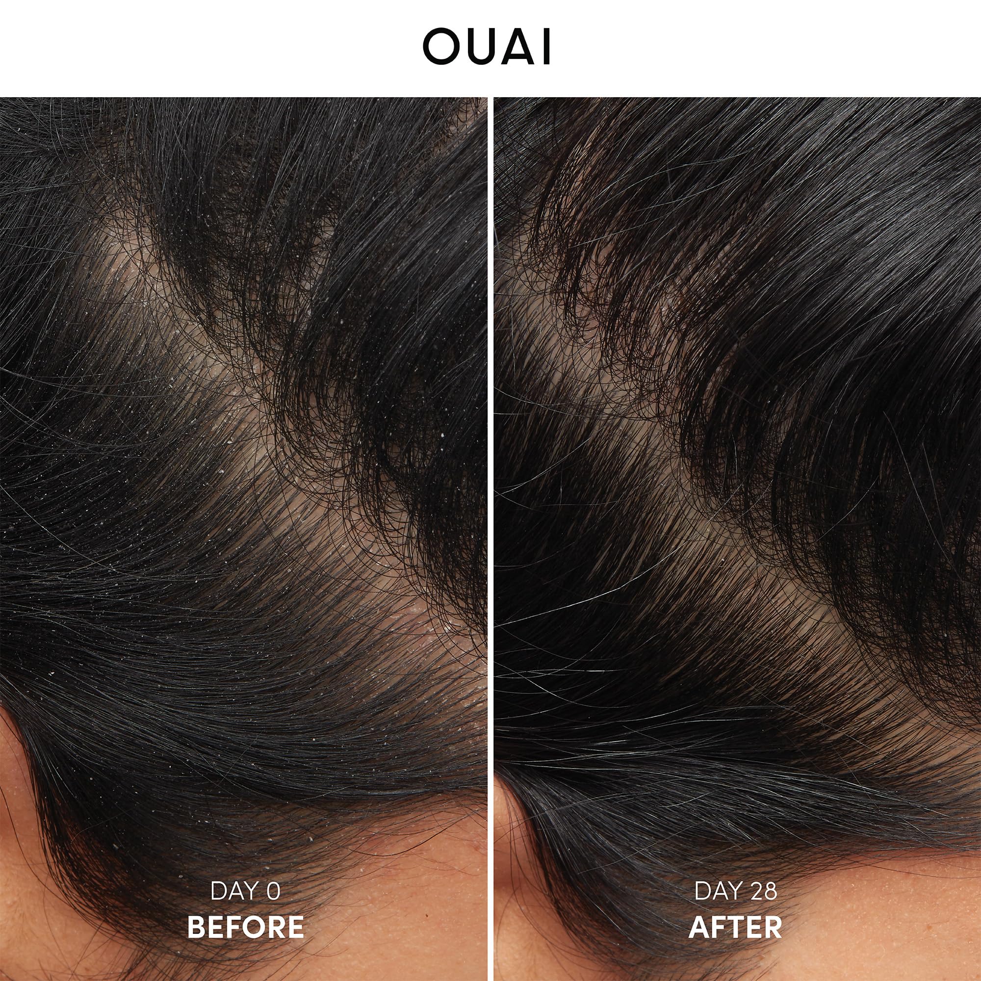 OUAI anti-dandruff shampoo closeup label highlights salicylic acid benefits