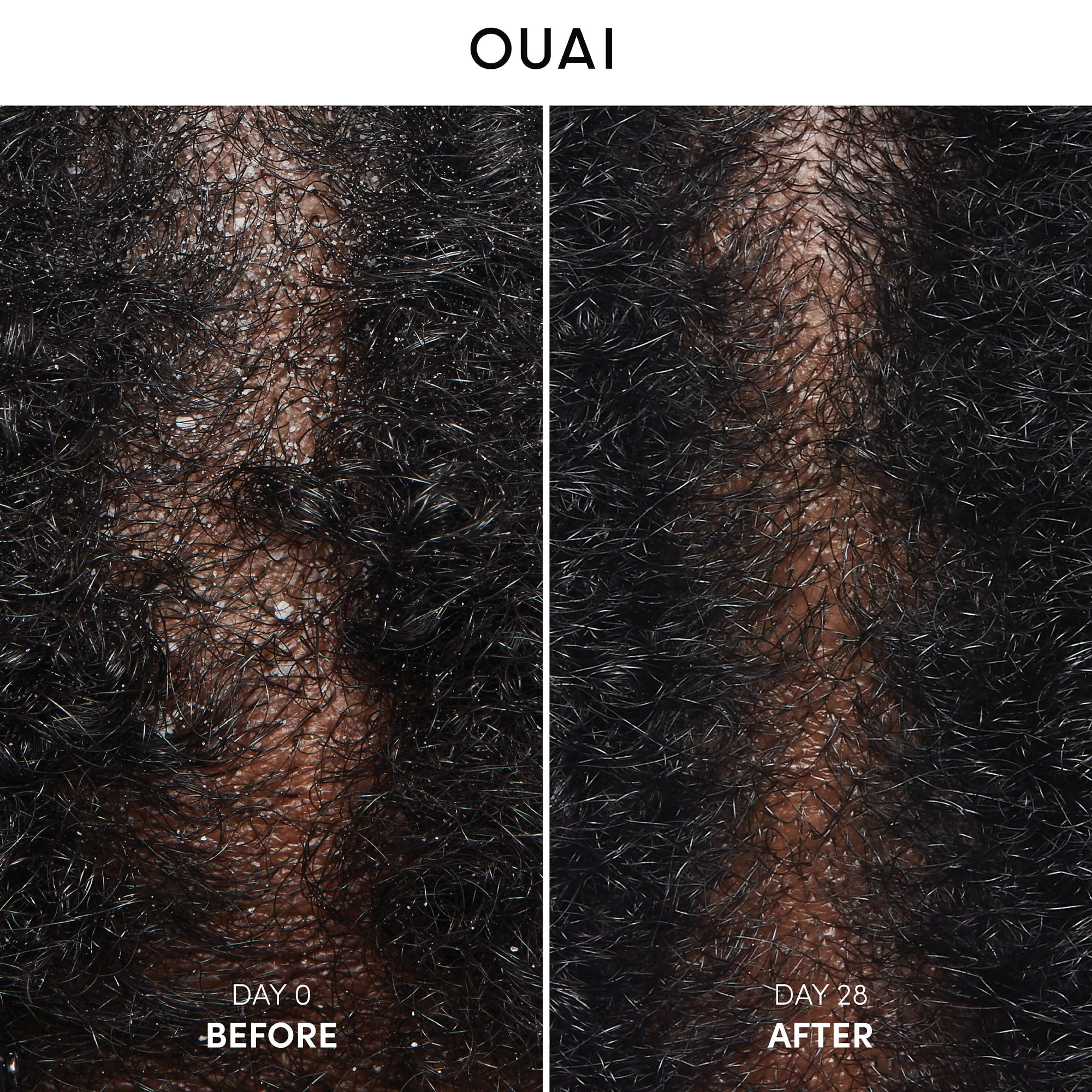 OUAI anti-dandruff shampoo lathering for clean, refreshed scalp
