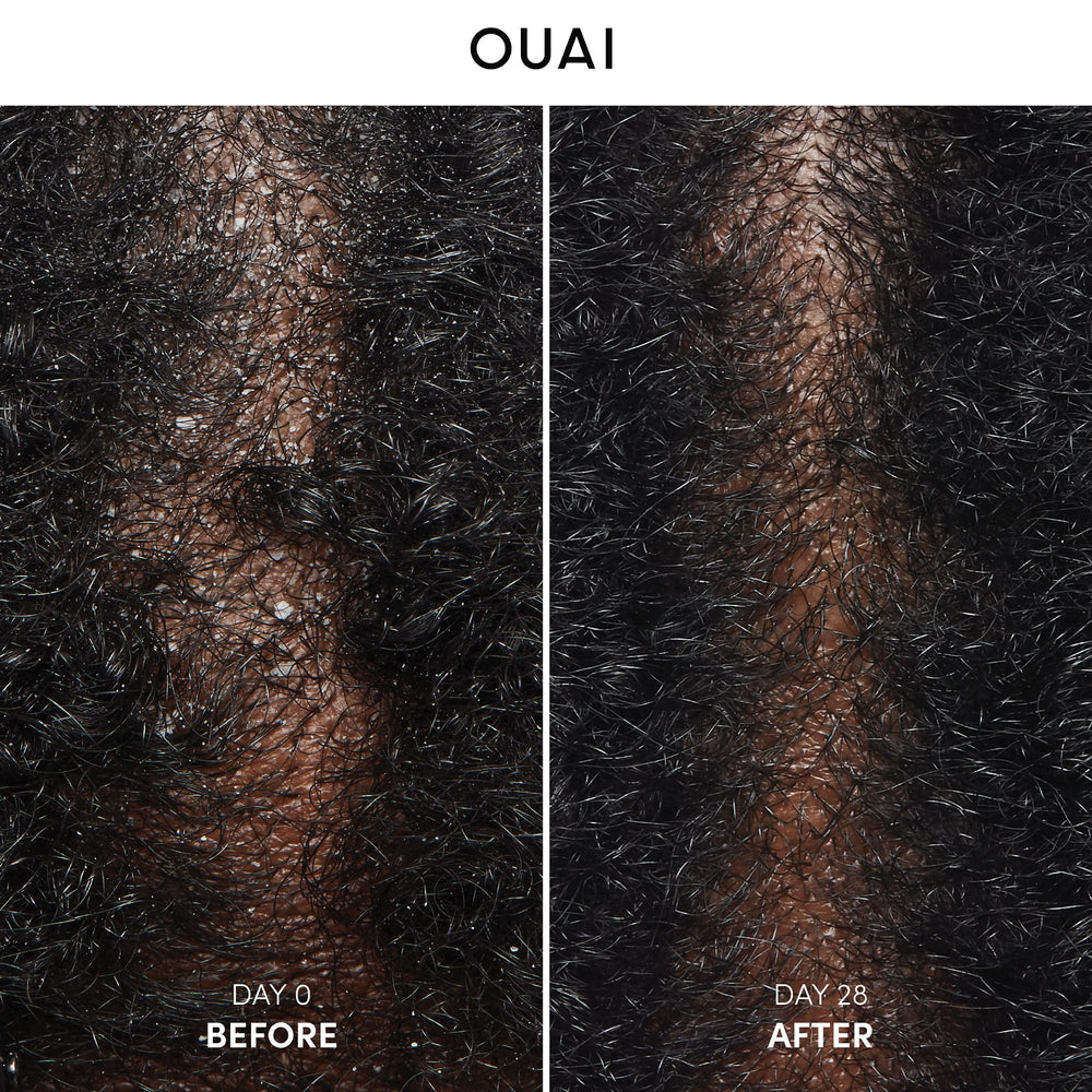OUAI anti-dandruff shampoo lathering for clean, refreshed scalp