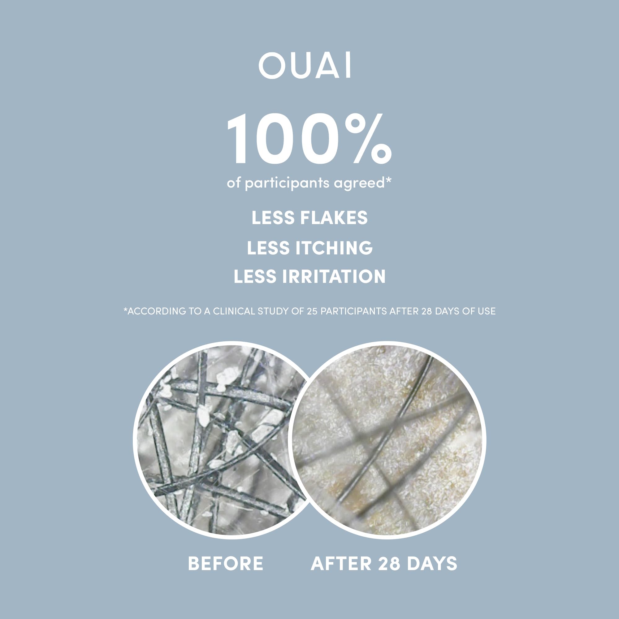 OUAI salicylic acid illustration emphasizing flakes reduction and scalp comfort